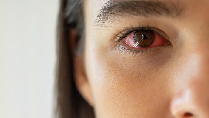 1762148527728-mata-merah_169